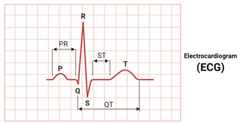 resting electrocardiographic results|Electrocardiogram (ECG or EKG) .